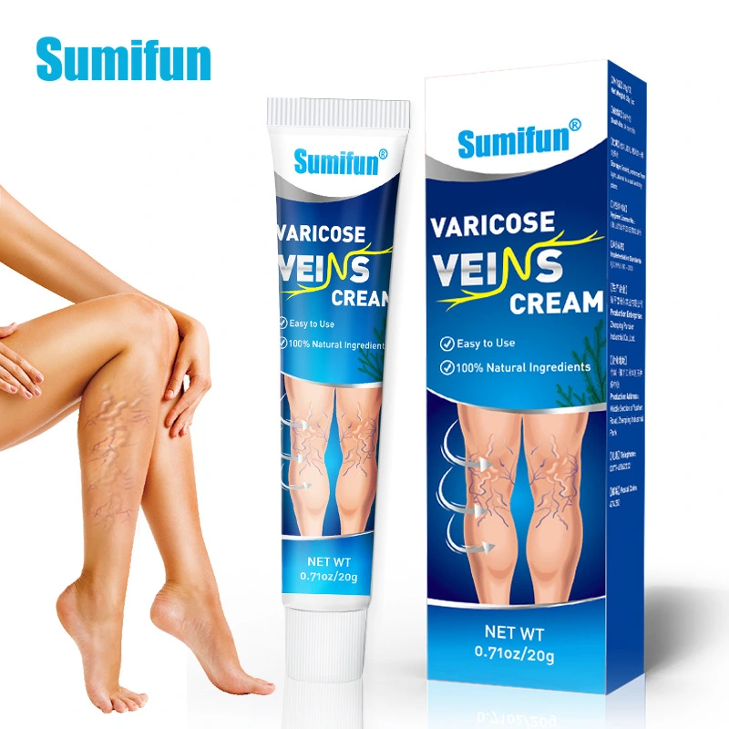 varicose vein cream